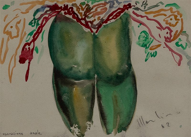 ALDO MONDINO Operazione anale, 1962